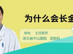 為什么會長金頭發